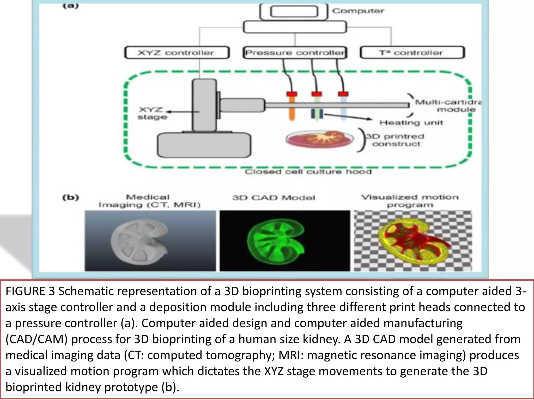 FIGURE 3 Schematic representation of a 3D bioprinting system consisting of a computer aided 3-
axis stage controller and a deposition module including three different print heads connected to
a pressure controller (a). Computer aided design and computer aided manufacturing
(CAD/CAM) process for 3D bioprinting of a human size kidney. A 3D CAD model generated from
medical imaging data (CT: computed tomography; MRI: magnetic resonance imaging) produces
a visualized motion program which dictates the XYZ stage movements to generate the 3D
bioprinted kidney prototype (b).
 