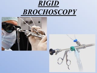 RIGID
BROCHOSCOPY
 