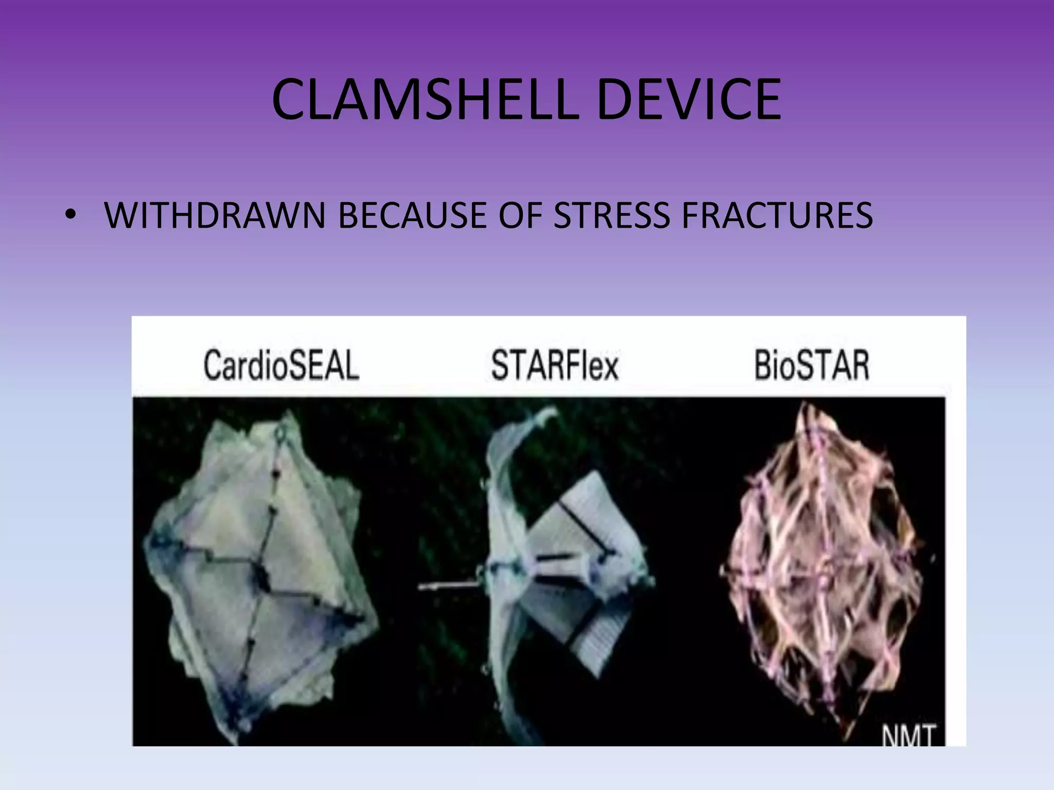 CLAMSHELL DEVICE
• WITHDRAWN BECAUSE OF STRESS FRACTURES