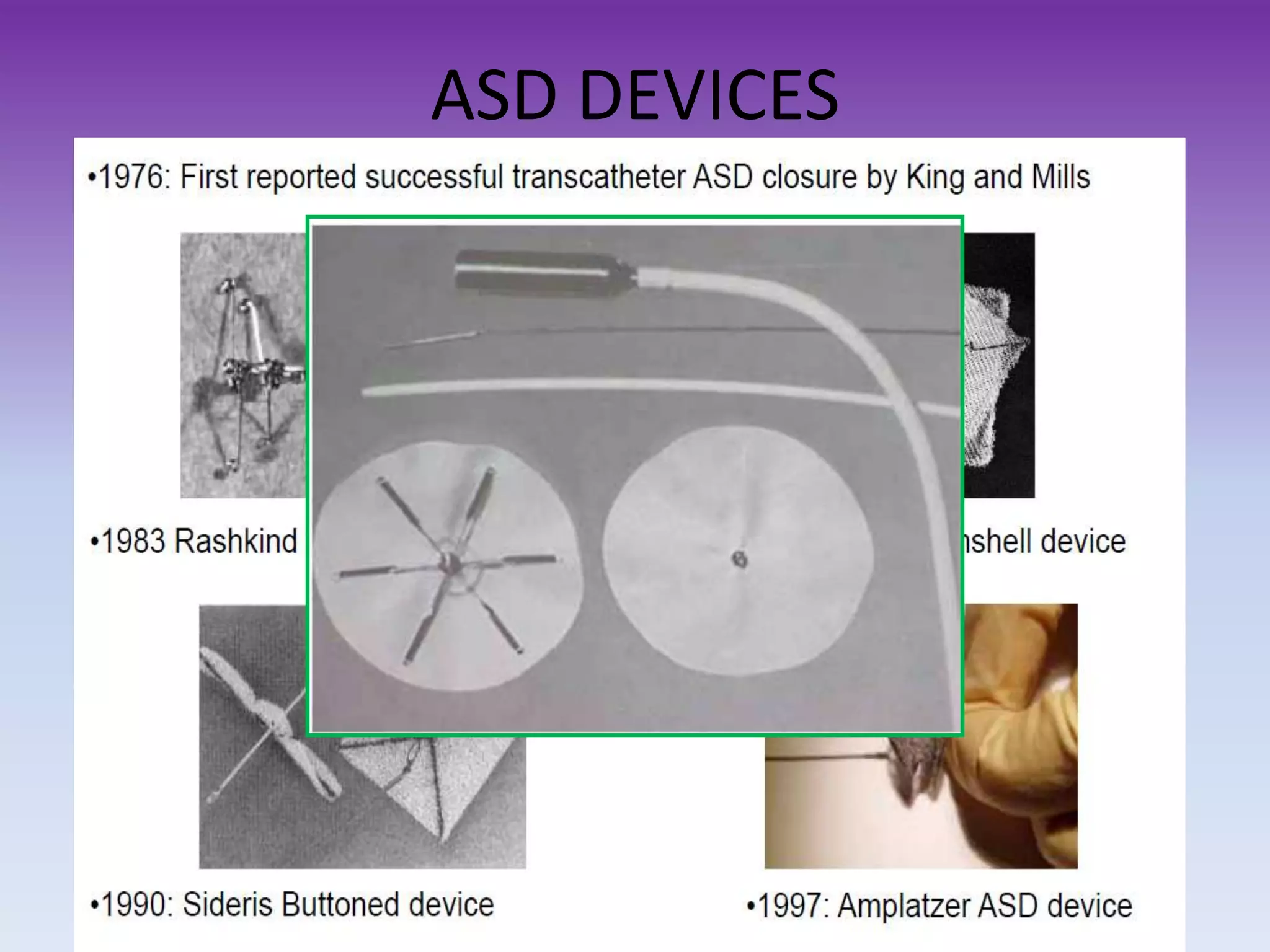 ASD DEVICES