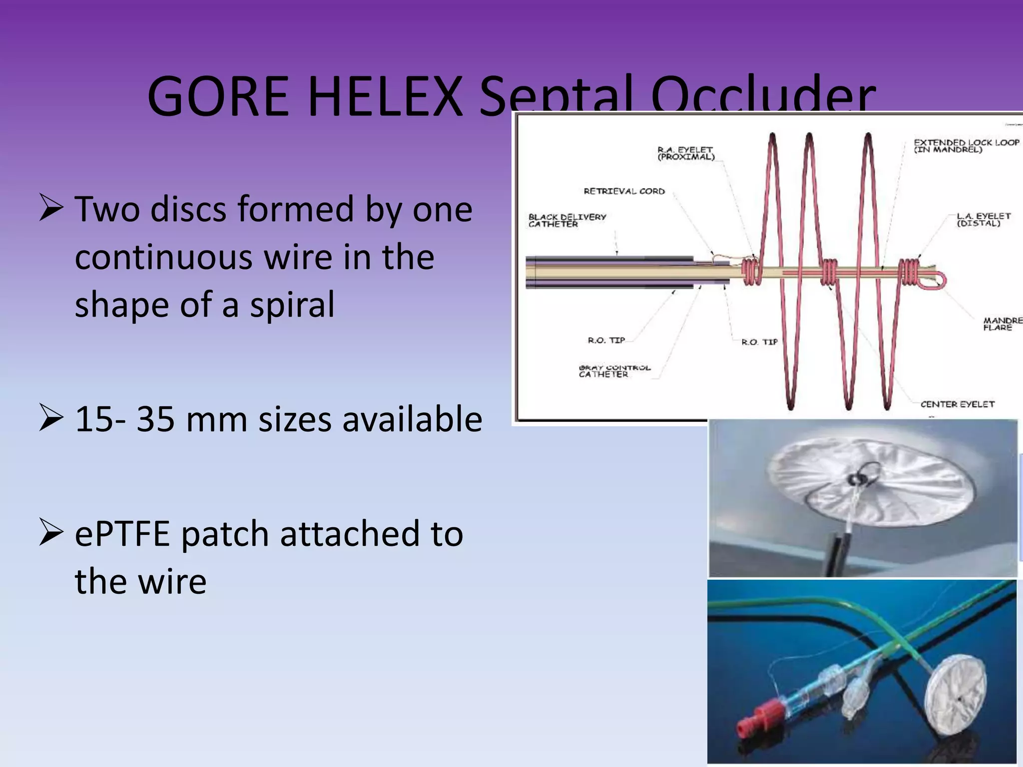 GORE HELEX Septal Occluder
Two discs formed by one
continuous wire in the
shape of a spiral
15- 35 mm sizes available
ePTFE patch attached to
the wire