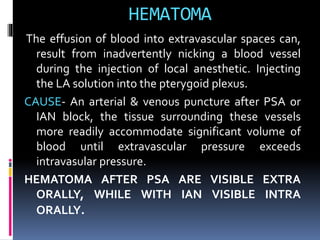 Extravascular Injection maxillary nerve block | PPTX