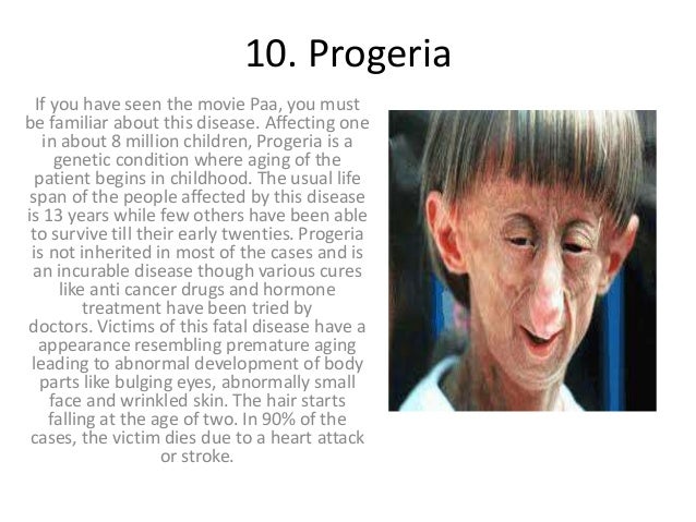 Top 10 Rarest Diseases