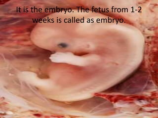 It is the embryo. The fetus from 1-2
weeks is called as embryo.
 