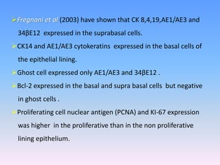Fregnani et al (2003) have shown that CK 8,4,19,AE1/AE3 and
34βE12 expressed in the suprabasal cells.
CK14 and AE1/AE3 cytokeratins expressed in the basal cells of
the epithelial lining.
Ghost cell expressed only AE1/AE3 and 34βE12 .
Bcl-2 expressed in the basal and supra basal cells but negative
in ghost cells .
Proliferating cell nuclear antigen (PCNA) and KI-67 expression
was higher in the proliferative than in the non proliferative
lining epithelium.
 