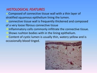 HISTOLOGICAL FEATURES
 Composed of connective tissue wall with a thin layer of
stratified squamous epithelium lining the lumen.
connective tissue wall is frequently thickened and composed
of a very loose fibrous connective tissue
Inflammatory cells commonly infiltrate the connective tissue.
Shows rushton bodies with in the lining epithelium.
Content of cystic lumen is usually thin, watery yellow and is
occasionally blood tinged.
 