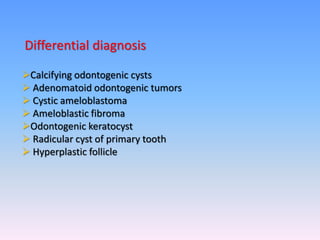Calcifying odontogenic cysts
 Adenomatoid odontogenic tumors
 Cystic ameloblastoma
 Ameloblastic fibroma
Odontogenic keratocyst
 Radicular cyst of primary tooth
 Hyperplastic follicle
Differential diagnosis
 