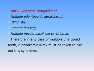 NBCCSyndrome composed of
Multiple odontogenic keratocysts.
 Bifid ribs.
 Frontal bossing.
Multiple nevoid basal cell carcinomas
Therefore in any case of multiple unerupted
teeth, a panaromic X ray must be taken to rule
out this syndrome.
 