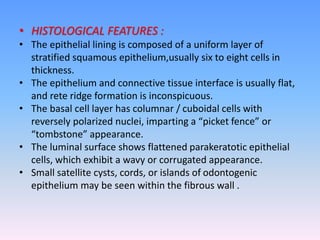 • HISTOLOGICAL FEATURES :
• The epithelial lining is composed of a uniform layer of
stratified squamous epithelium,usually six to eight cells in
thickness.
• The epithelium and connective tissue interface is usually flat,
and rete ridge formation is inconspicuous.
• The basal cell layer has columnar / cuboidal cells with
reversely polarized nuclei, imparting a “picket fence” or
“tombstone” appearance.
• The luminal surface shows flattened parakeratotic epithelial
cells, which exhibit a wavy or corrugated appearance.
• Small satellite cysts, cords, or islands of odontogenic
epithelium may be seen within the fibrous wall .
 