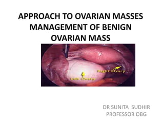 APPROACH TO OVARIAN MASSES
MANAGEMENT OF BENIGN
OVARIAN MASS
DR SUNITA SUDHIR
PROFESSOR OBG
 