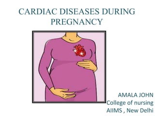 CARDIAC DISEASES DURING
PREGNANCY
AMALA JOHN
College of nursing
AIIMS , New Delhi
 