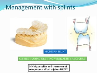 Modified Michigan Splint Adult Orthodontics | PPTX