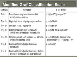 Modified Graf Classification Scale
 