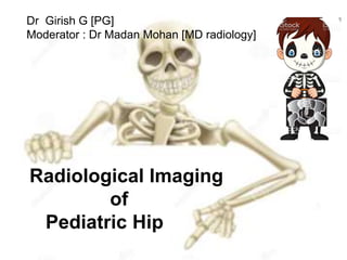 Radiological Imaging
of
Pediatric Hip
Dr Girish G [PG]
Moderator : Dr Madan Mohan [MD radiology]
 