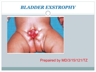BLADDER EXSTROPHY
Prepaired by MD/3/15/121/TZ
 