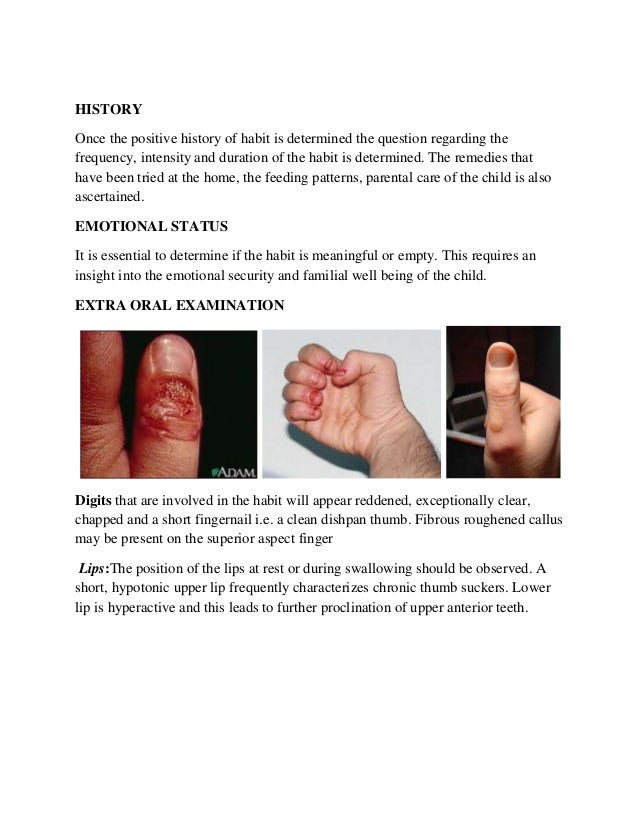 THUMB SUCKING HABIT