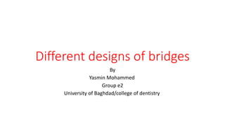 Different designs of bridges
By
Yasmin Mohammed
Group e2
University of Baghdad/college of dentistry
 