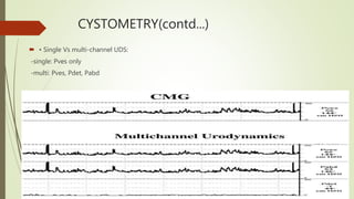 CYSTOMETRY(contd...)
 • Single Vs multi-channel UDS:
-single: Pves only
-multi: Pves, Pdet, Pabd
 