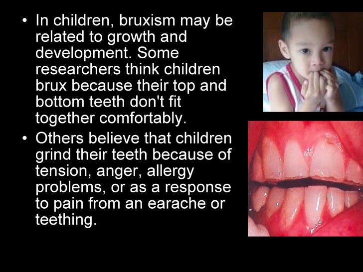 bruxism