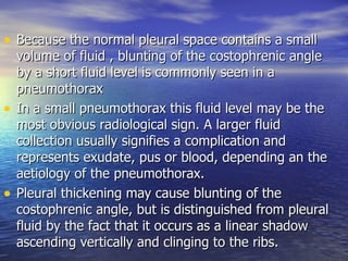 Because the normal pleural space contains a small volume of fluid , blunting of the costophrenic angle by a short fluid level is commonly seen in a pneumothorax In a small pneumothorax this fluid level may be the most obvious radiological sign. A larger fluid collection usually signifies a complication and represents exudate, pus or blood, depending an the aetiology of the pneumothorax.  Pleural thickening may cause blunting of the costophrenic angle, but is distinguished from pleural fluid by the fact that it occurs as a linear shadow ascending vertically and clinging to the ribs.  