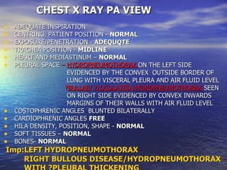 CHEST X RAY PA VIEW ADEQUATE INSPIRATION CENTRING, PATIENT POSITION -  NORMAL EXPOSURE/PENETRATION -  ADEQUQTE TRACHEA POSITION -  MIDLINE HEART AND MEDIASTINUM –  NORMAL PLEURAL SPACE  –  HYDROPNEUMOTHORAX  ON THE LEFT SIDE  EVIDENCED BY THE CONVEX  OUTSIDE BORDER OF  LUNG WITH VISCERAL PLEURA AND AIR FLUID LEVEL ? BULLAE/ ?LOCULATED HYDROPNEUMOTHORAX  SEEN  ON RIGHT SIDE EVIDENCED BY CONVEX INWARDS  MARGINS OF THEIR WALLS WITH AIR FLUID LEVEL COSTOPHRENIC ANGLES  BLUNTED BILATERALLY  CARDIOPHRENIC ANGLES  FREE HILA DENSITY, POSITION, SHAPE -  NORMAL SOFT TISSUES –  NORMAL BONES-  NORMAL Imp:LEFT HYDROPNEUMOTHORAX  RIGHT BULLOUS DISEASE/HYDROPNEUMOTHORAX WITH ?PLEURAL THICKENING   
