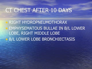 CT CHEST AFTER 10 DAYS RIGHT HYDROPNEUMOTHORAX EMPHYSEMATOUS BULLAE IN B/L LOWER LOBE, RIGHT MIDDLE LOBE B/L LOWER LOBE BRONCHIECTASIS 