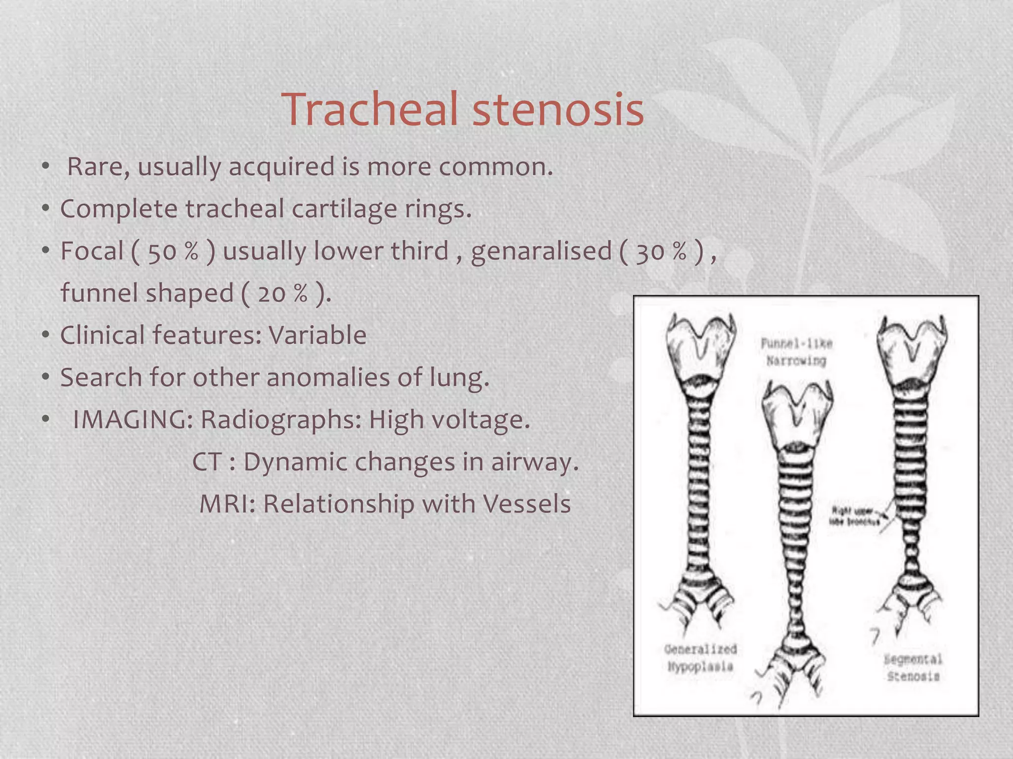 Tracheal Rings Radiopaedia congenital lung disorders : radiology | PPTX