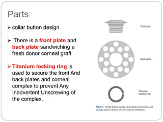 Parts
collar button design
 There is a front plate and
back plate sandwiching a
fresh donor corneal graft
Titanium locking ring is
used to secure the front And
back plates and corneal
complex to prevent Any
Inadvertent Unscrewing of
the complex.
 
