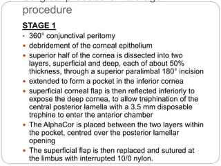 Surgical procedure-- 2 stage
procedure
STAGE 1
• 360° conjunctival peritomy
 debridement of the corneal epithelium
 superior half of the cornea is dissected into two
layers, superﬁcial and deep, each of about 50%
thickness, through a superior paralimbal 180° incision
 extended to form a pocket in the inferior cornea
 superﬁcial corneal ﬂap is then reﬂected inferiorly to
expose the deep cornea, to allow trephination of the
central posterior lamella with a 3.5 mm disposable
trephine to enter the anterior chamber
 The AlphaCor is placed between the two layers within
the pocket, centred over the posterior lamellar
opening
 The superﬁcial ﬂap is then replaced and sutured at
the limbus with interrupted 10/0 nylon.
 