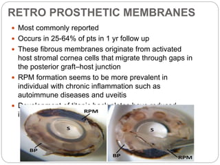 RETRO PROSTHETIC MEMBRANES
 Most commonly reported
 Occurs in 25-64% of pts in 1 yr follow up
 These ﬁbrous membranes originate from activated
host stromal cornea cells that migrate through gaps in
the posterior graft–host junction
 RPM formation seems to be more prevalent in
individual with chronic inﬂammation such as
autoimmune diseases and uveitis
 Development of titanic back plates have reduced
incidence
 