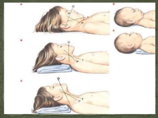 Copur Score PEDIATRIC AIRWAY EVALUATION & MANAGEMENT | PPTX