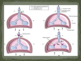 Copur Score PEDIATRIC AIRWAY EVALUATION & MANAGEMENT | PPTX