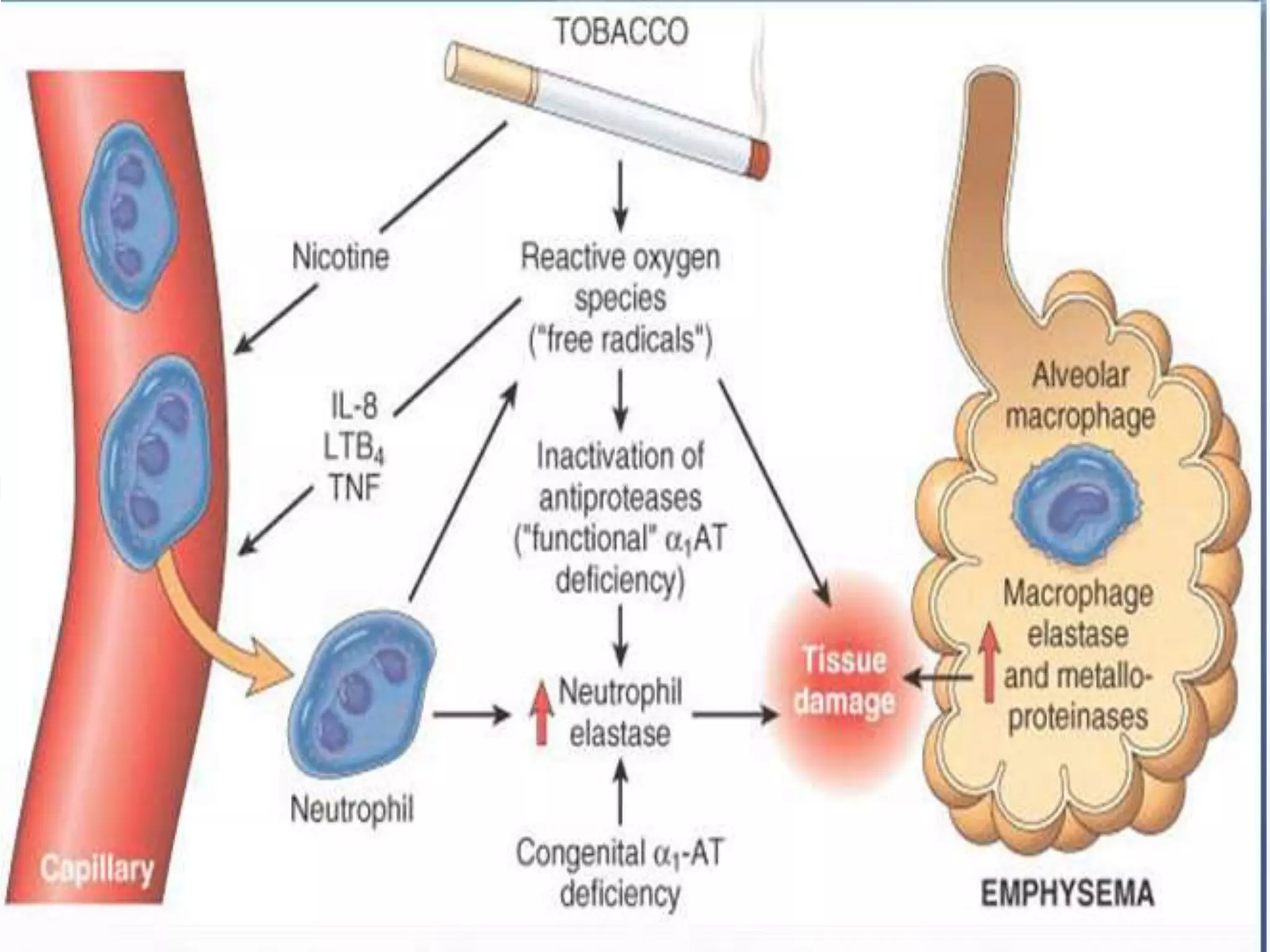 aetiology and pathogenesis of chronic obstructive lung disease | PPTX