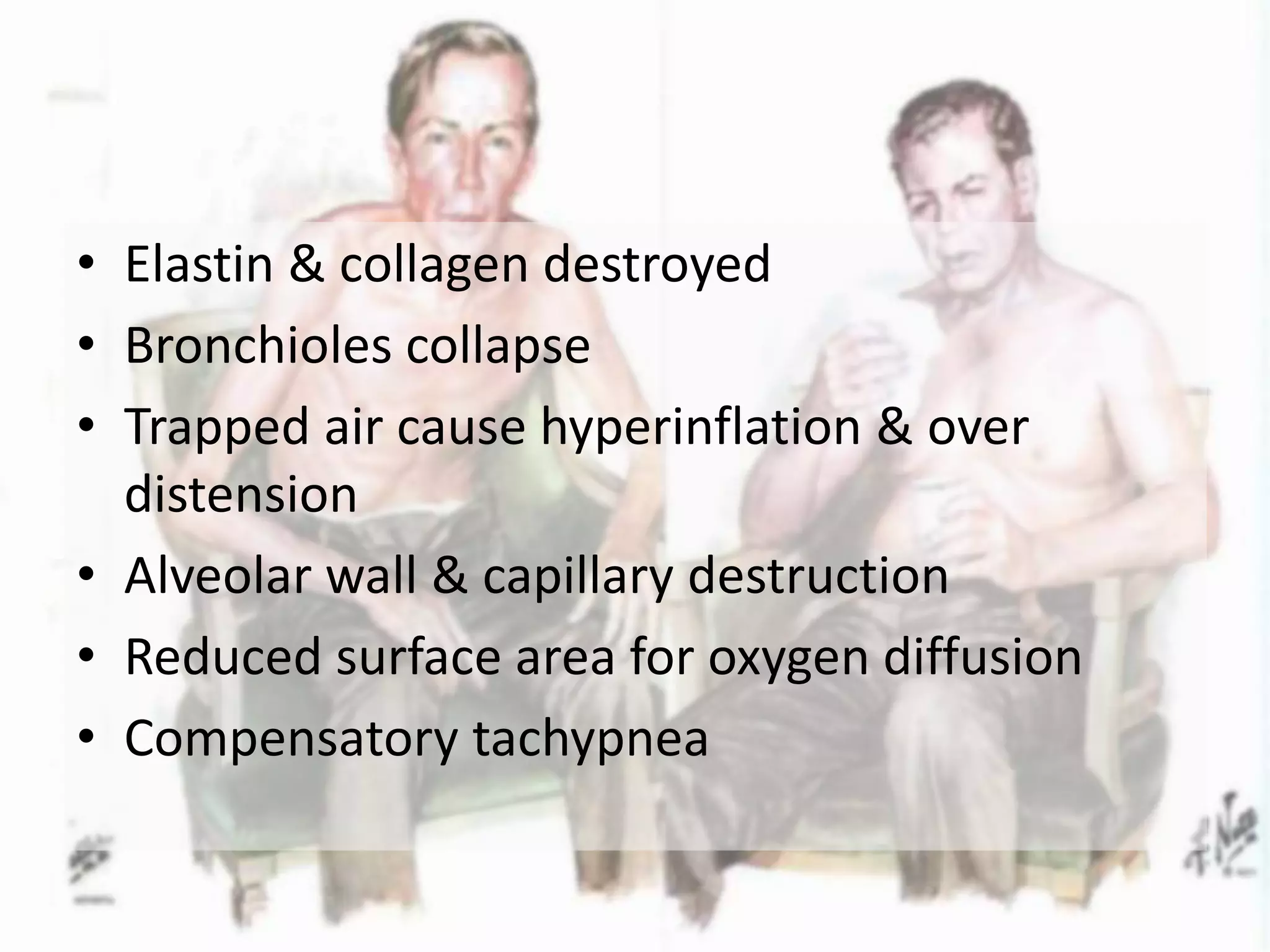 aetiology and pathogenesis of chronic obstructive lung disease | PPTX