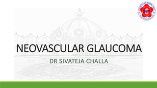NEOVASCULAR GLAUCOMA
DR SIVATEJA CHALLA
 