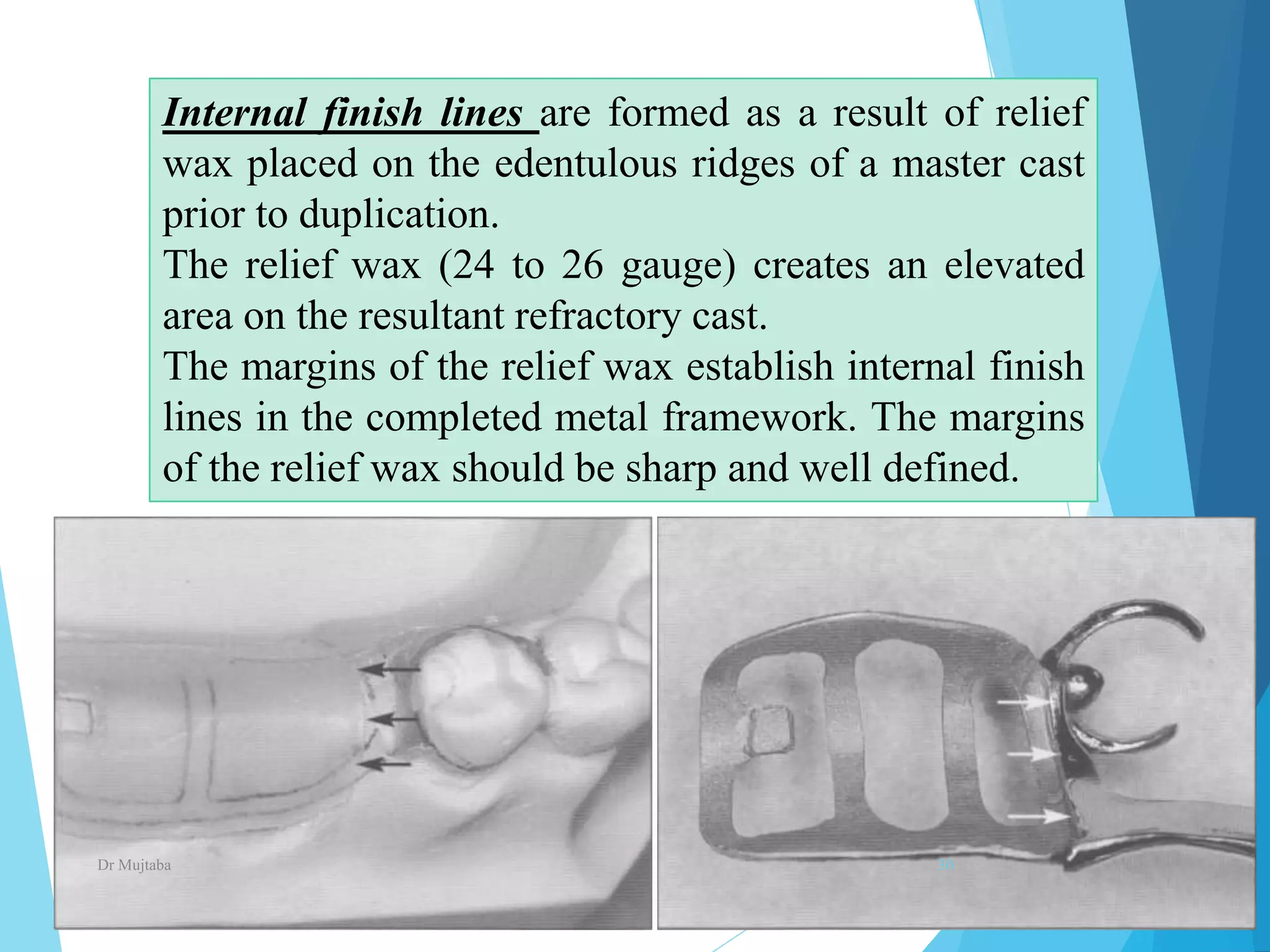 Minor connectors, rests & rests seats In prosthodontics | PPTX
