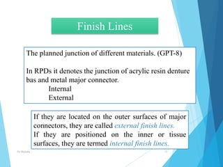 External Finish Line Rpd Minor connectors, rests & rests seats In prosthodontics | PPTX