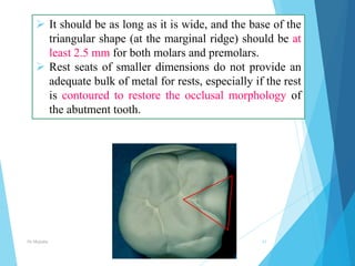 Marginal Ridge Rests Minor connectors, rests & rests seats In prosthodontics | PPTX