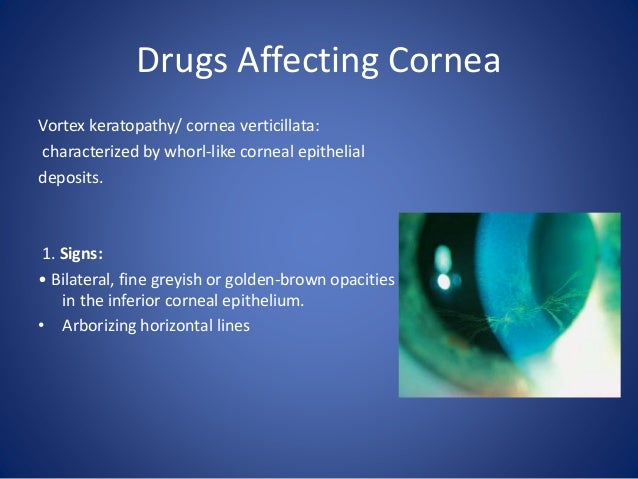 Amiodarone Side Effects Eye