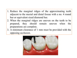 Comprehensive Guide to Mouth Preparation for Removable Partial Dentures ...