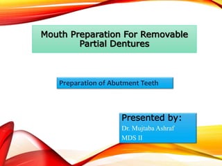 Mouth Preparation For Removable
Partial Dentures
Presented by:
Dr. Mujtaba Ashraf
MDS II
Preparation of Abutment Teeth
 