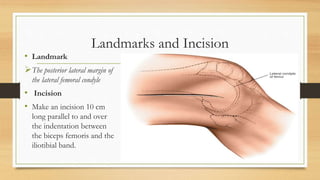 SURGICAL APPROACHES TO KNEE JOINT | PPTX