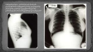 რენტგენის სხივები