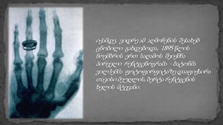 რენტგენის სხივები