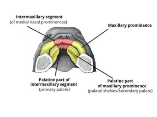 Development of Face and Palate including Anomalies of palate | PPTX