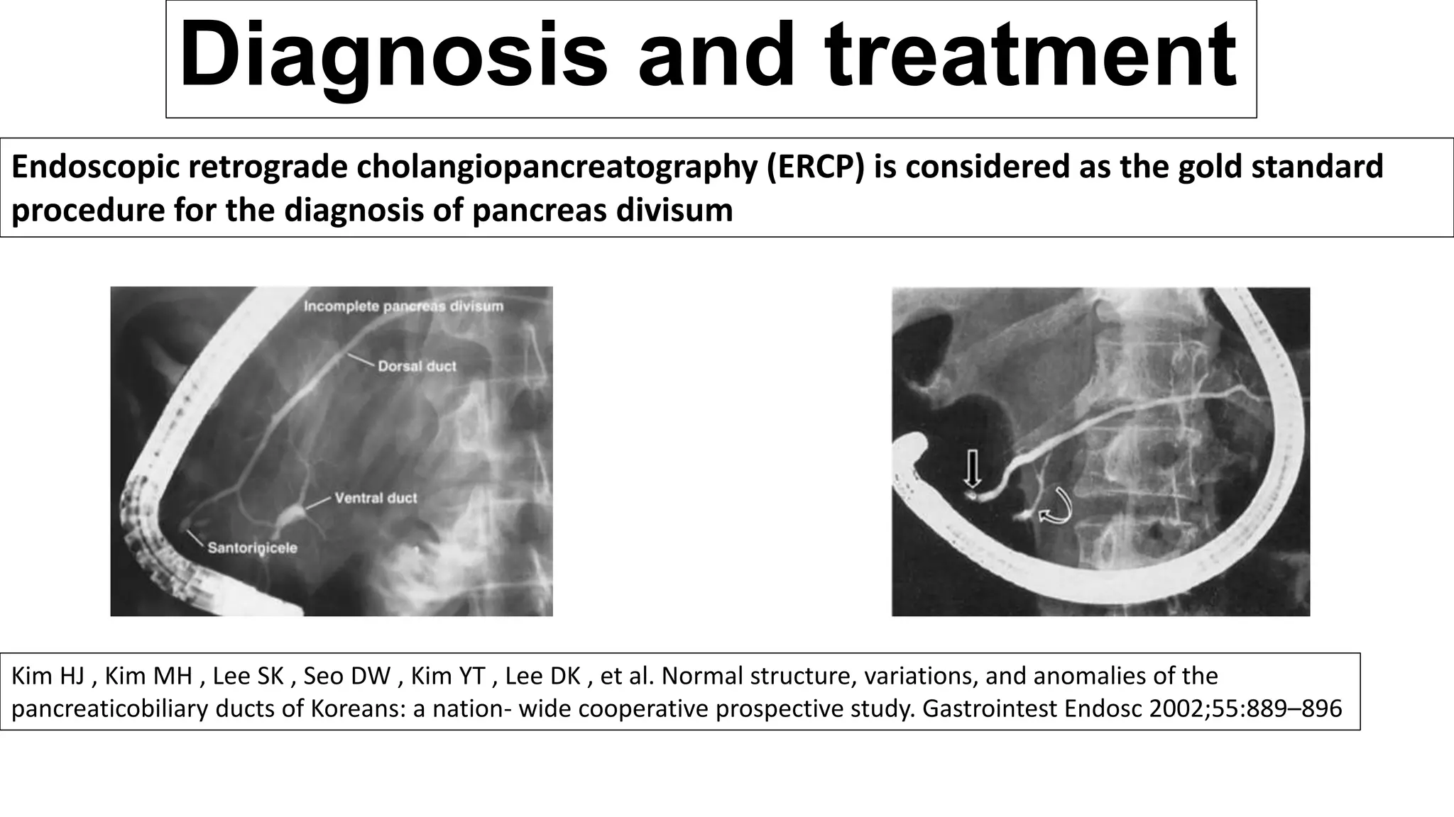 Diagnosis and treatment
Endoscopic retrograde cholangiopancreatography (ERCP) is considered as the gold standard
procedure for the diagnosis of pancreas divisum
Kim HJ , Kim MH , Lee SK , Seo DW , Kim YT , Lee DK , et al. Normal structure, variations, and anomalies of the
pancreaticobiliary ducts of Koreans: a nation- wide cooperative prospective study. Gastrointest Endosc 2002;55:889–896
 