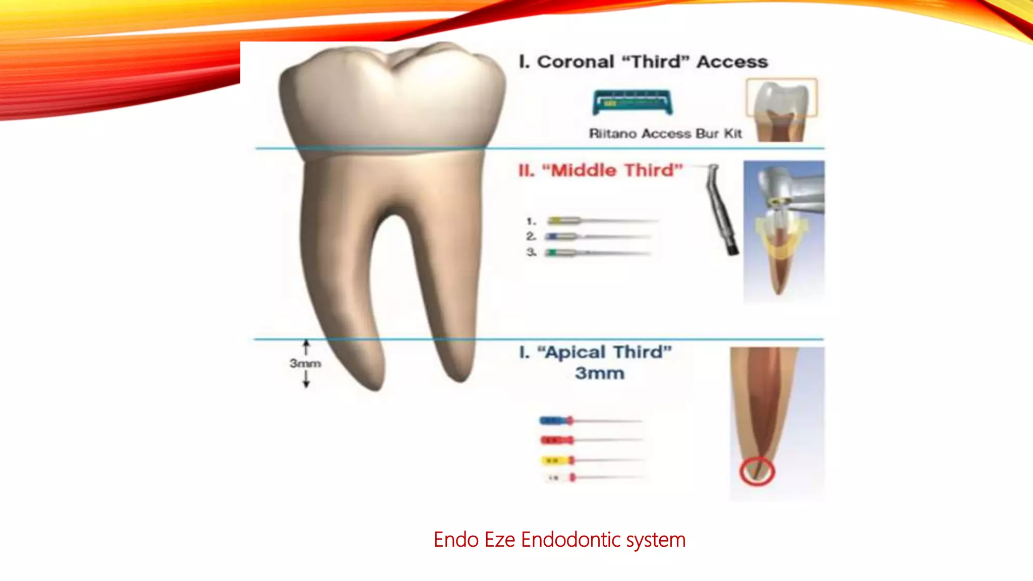 Minimal Invasive Endodontics PPTX