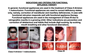 INDICATIONS AND CRITERIA FOR FUNCTIONAL
APPLIANCE THERAPY
In general, functional appliances are used in the treatment of Class II division
1 malocclusion. Functional appliances are used to correct deficiency states
only, namely, correction of mandibular and maxillary deficiencies. A case with
functional retrusion responds well with functional appliance therapy.
Functional appliances are used in the management of Class III due to
retrognathic maxilla in a growing child. Other indications are prevention and
correction of deleterious oral habits that include digit sucking, lip sucking,
mouth breathing and other functional aberrations.
Class II division 1 malocclusion. Class III
 