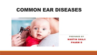 COMMON EAR DISEASES
PREPARED BY
MARTIN SHAJI
PHARM D
 