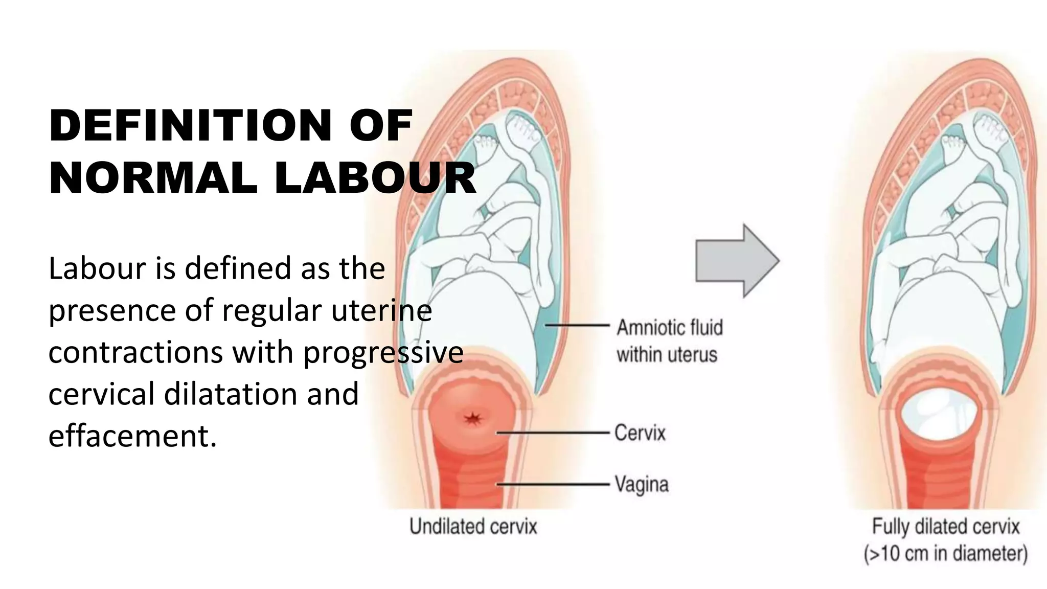 Labor Def a detail study on normal labour ( definition, stages of labour ...